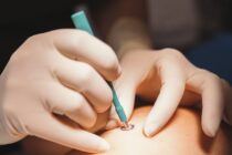 biopsy 4 min scaled 1