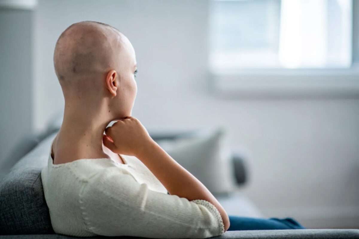 Queda de Cabelo no Câncer: O Que Fazer, Quando Volta e Como Cuidar 1 Queda de Cabelo no Câncer: O Que Fazer, Quando Volta e Como Cuidar